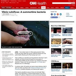 Vibrio vulnificus: A summertime bacteria