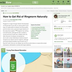 3 Ways to Get Rid of Ringworm Naturally