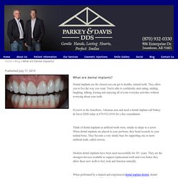 What are dental implants - Jonesboro AR