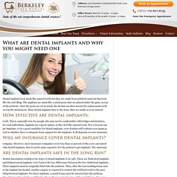 What are dental implants and why you might need one