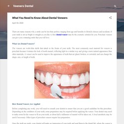 What You Need to Know About Dental Veneers
