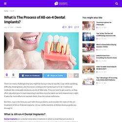 What is The Process of All-on-4 Dental Implants?