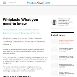 Whiplash: What you need to know