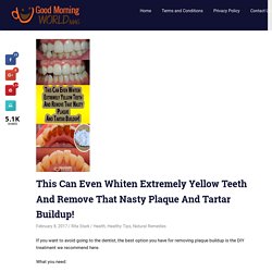 This Can Even Whiten Extremely Yellow Teeth And Remove That Nasty Plaque And Tartar Buildup!