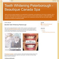 Teeth Whitening Peterborough - Beautique Canada Spa: Benefits Teeth Whitening Peterborough