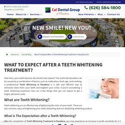 What To Expect After a Teeth Whitening Treatment?