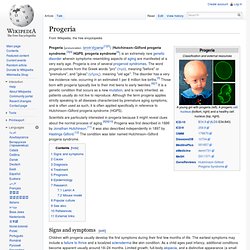 Progeria