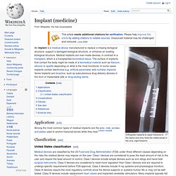 Implant (medicine)