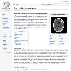 Sturge–Weber syndrome
