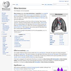 Situs inversus
