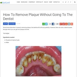 How To Remove Plaque Without Going To The Dentist